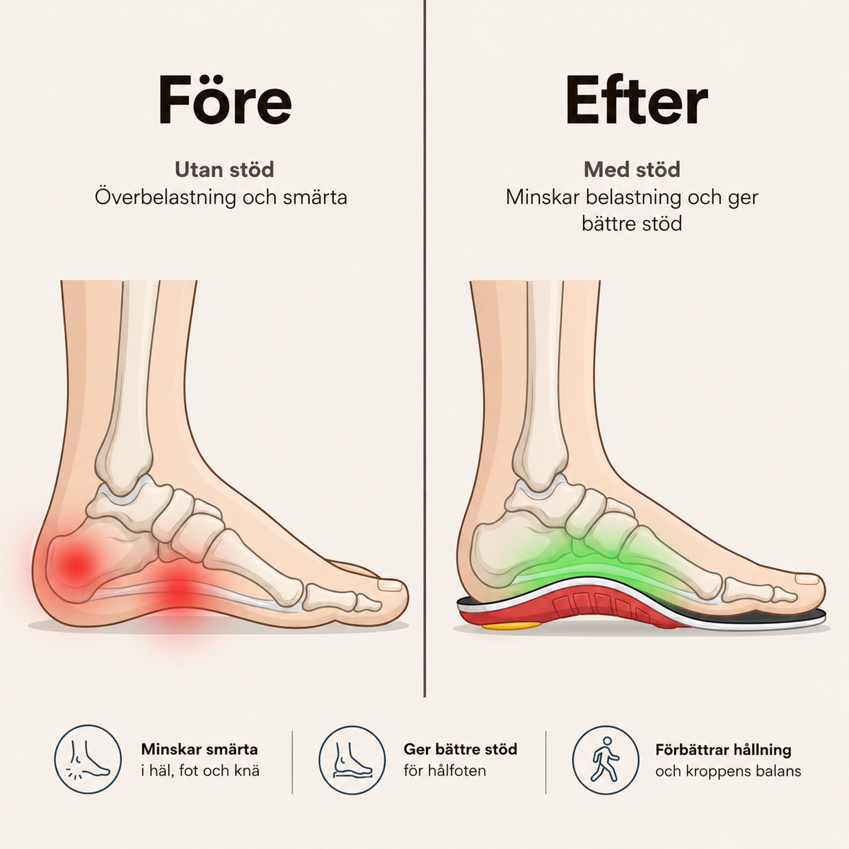 Needyknee FlexStep™ - Ortopediska stödsulor för bättre komfort hela dagen